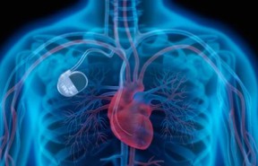 High risk medical device